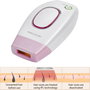 Profi-Care PC-IPL 3024 330240 Szőrtelenítő lézer Gyöngyház, Orgona 5. bélyegkép