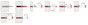 Fischer DuoPower 6x30 EasyHook Round K (6) Tipli készlet 557923 1 készlet 6. bélyegkép