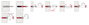 Fischer DuoPower 6x30 EasyHook Loop K (6) Tipli készlet 557926 1 készlet 6. bélyegkép